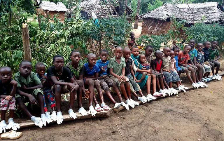 Children receive treatment for jiggers africa 2